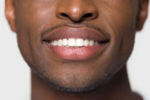 Close up cropped image young man face with ultra snow white smile teeth information teeth facts general dentistry dentist in Nashville Tennessee