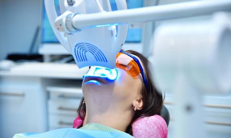 While there are countless over-the-counter products, professional teeth whitening remains the most effective and safest option.