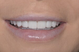 Main Gallery Image 5 | Smile Gallery