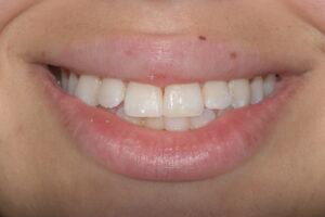 Main Gallery Image 1 | Smile Gallery