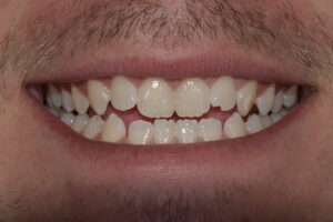 Main Gallery Image 2 | Smile Gallery