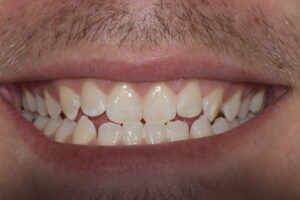 Secondary Gallery Image 2 | Smile Gallery