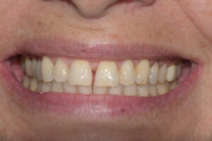 Secondary Gallery Image 3 | Smile Gallery