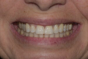 Main Gallery Image 3 | Smile Gallery