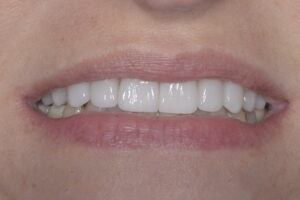 Main Gallery Image 7 | Smile Gallery