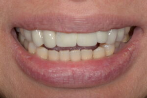 Secondary Gallery Image 6 | Smile Gallery