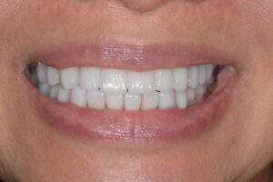 Main Gallery Image 6 | Smile Gallery