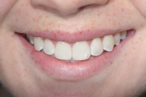 Main Gallery Image 8 | Smile Gallery