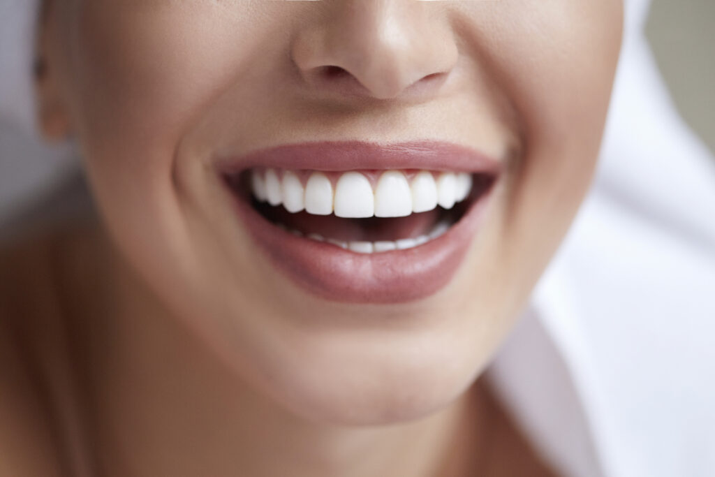 Porcelain Veneers Nashville TN